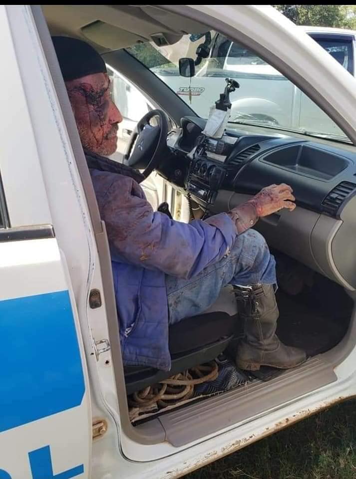 Trabajador atacado-artigas