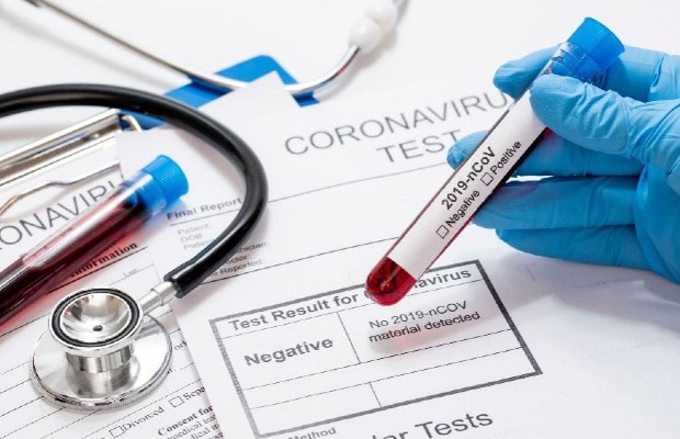 test coronavirus