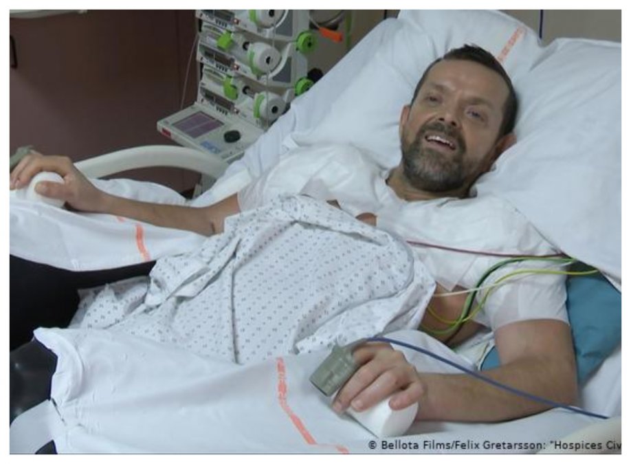 Implante de ambos brazos