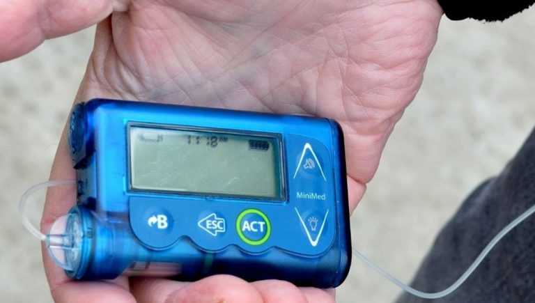 Bomba insulina -pixabay