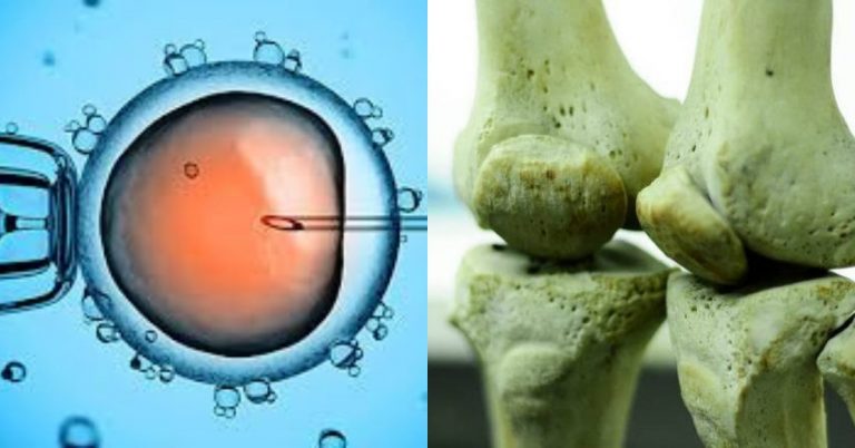 Célula inyectada y huesos