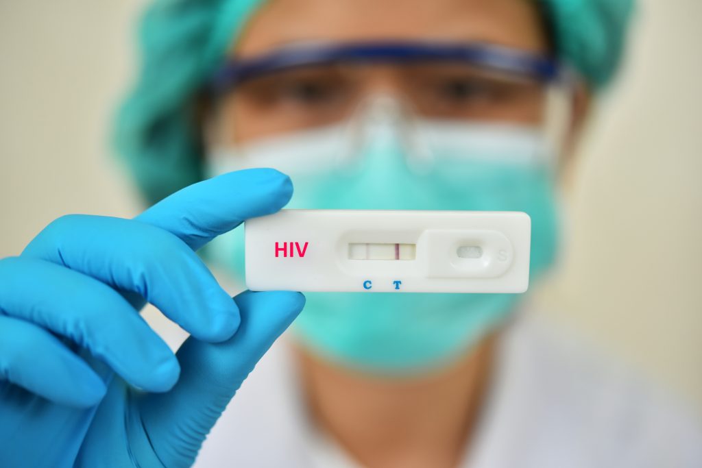 HIV test